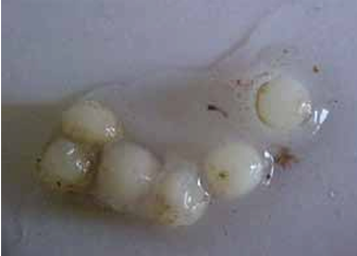 saprolegniasis